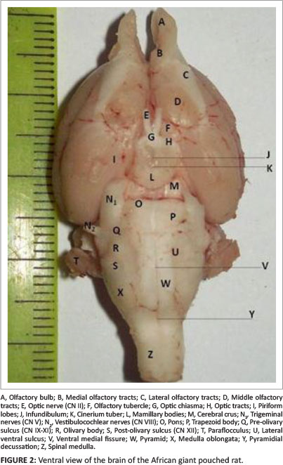 Diagram Of Olfactory Nerve