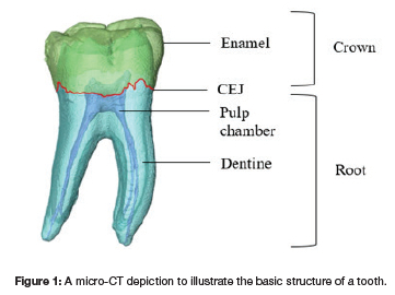 Dentine thicknesses of first molar roots: A review of the literature ...
